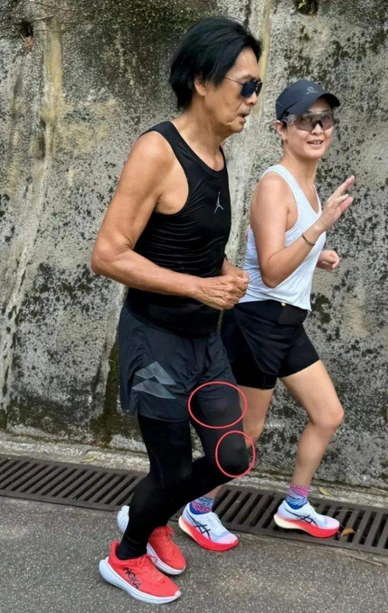 辟謠 周潤發否認患腫瘤 稱是皮下脂肪