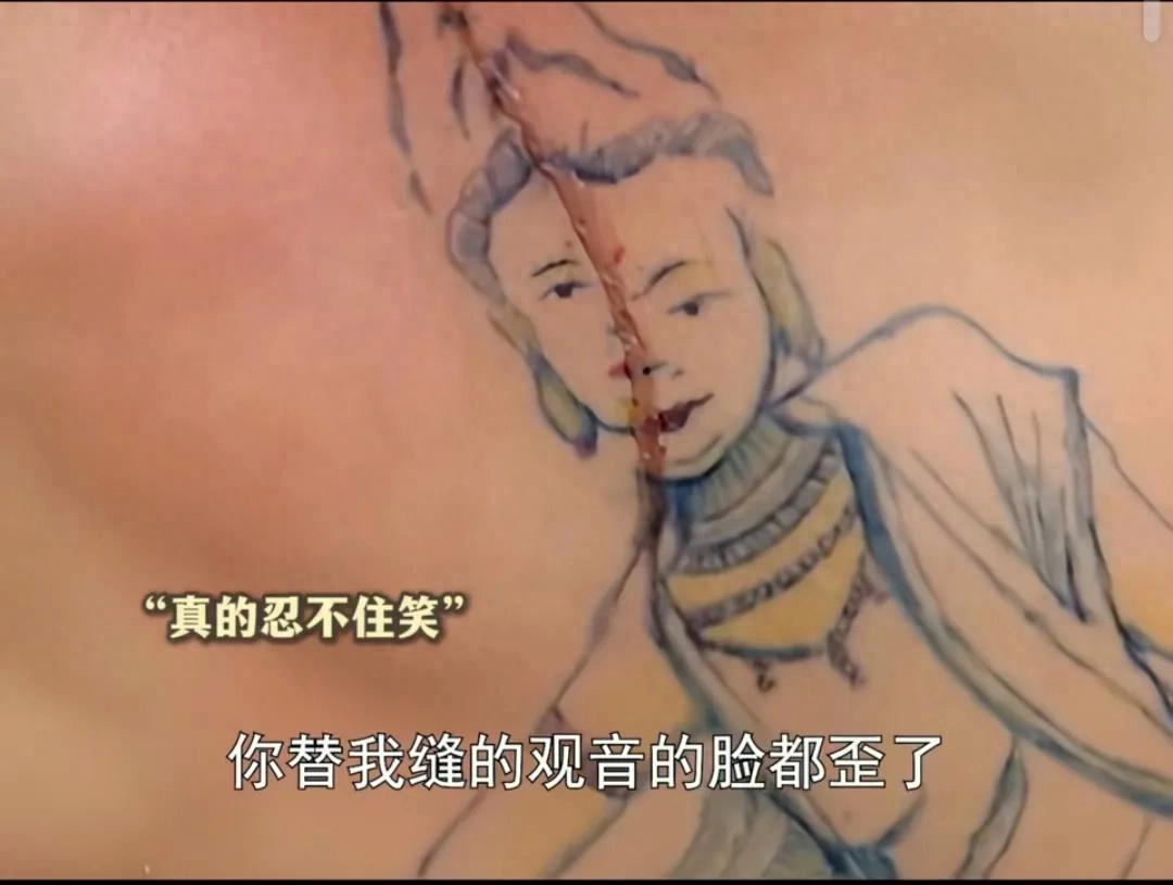 醫生給刺青患者“縫龍”直呼太難了